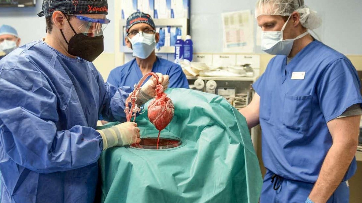 Greffe d'organes : l’Espagne premier pays donateur au niveau mondial