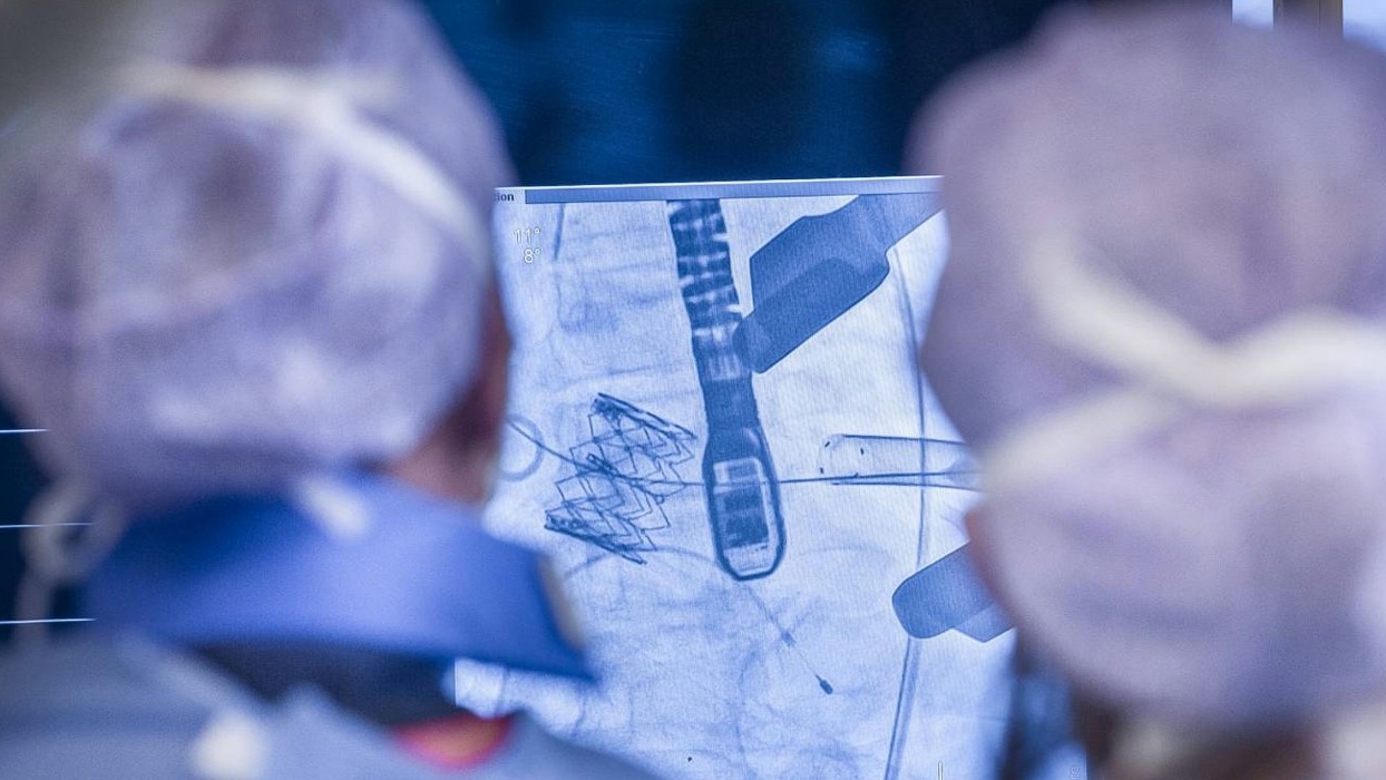 Agadir: Le CHU Mohammed VI réalise avec succès sa première angioplastie coronaire