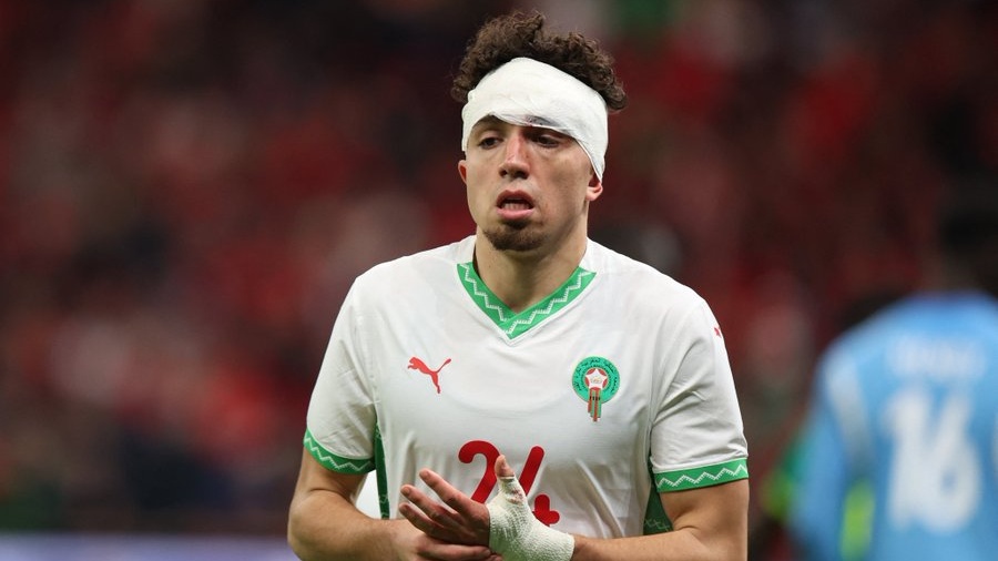 Rome : Neil el Aynaoui victime d’un cambriolage violent