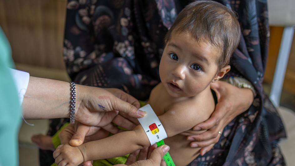 Malnutrition infantile en Afghanistan