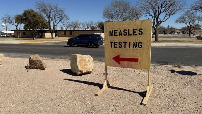Santé : Les Américains confrontés à une épidémie de rougeole
