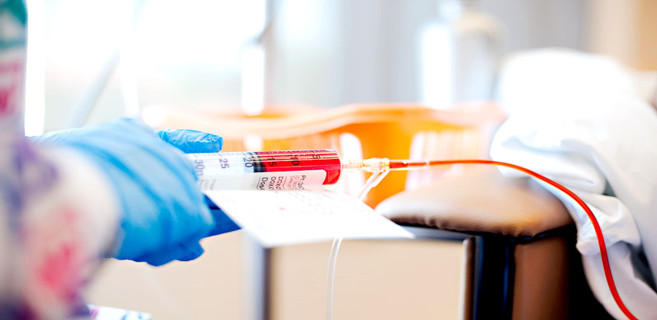 Le dilemme des patients cancéreux face au coronavirus