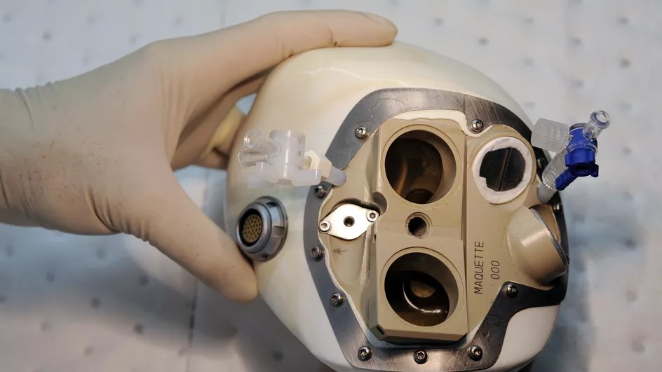 Transplantation : Vers une commercialisation des cœurs artificiels