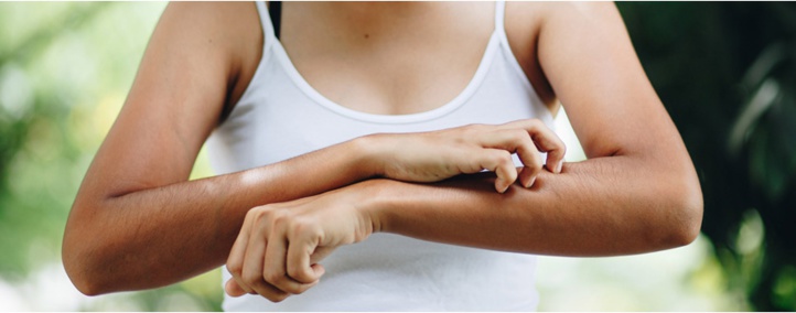 Huiles essentielles, répulsifs, bracelets... Comment se protéger contre les moustiques ?