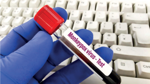 L’OMS minimise le risque de propagation