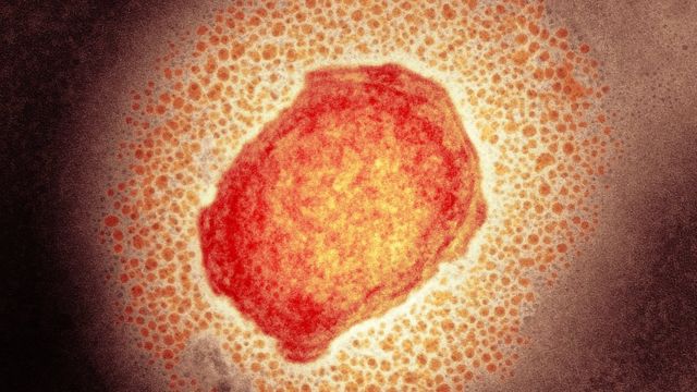 Variole du singe : Baitas se prononce sur les mesures gouvernementales