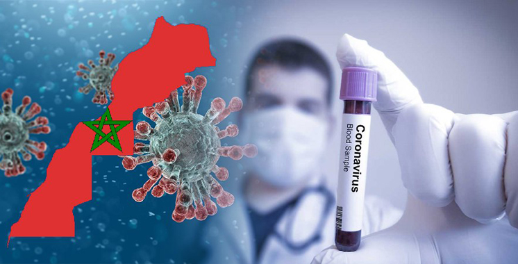 Covid-19: 101 nouveaux cas et aucun décès enregistré en 24 heures