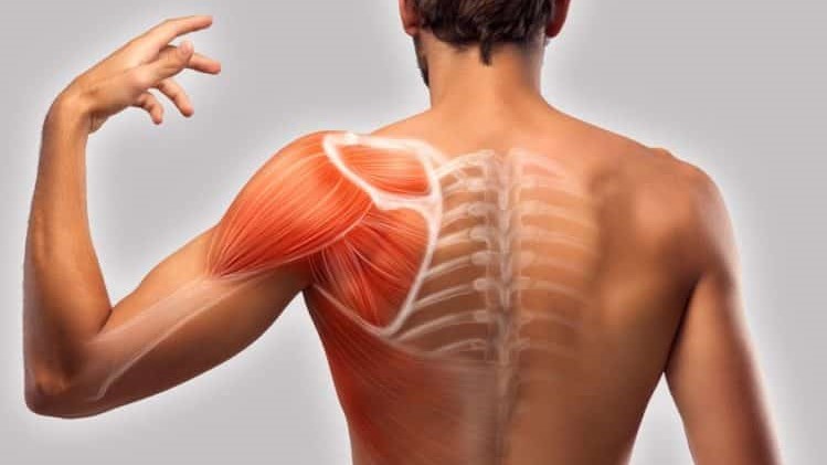 Santé : Noeuds musculaires, comment les soulager ?