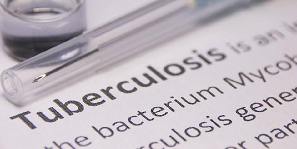 Casablanca : Un nouveau centre dédié au diagnostic de la tuberculose et maladies respiratoires