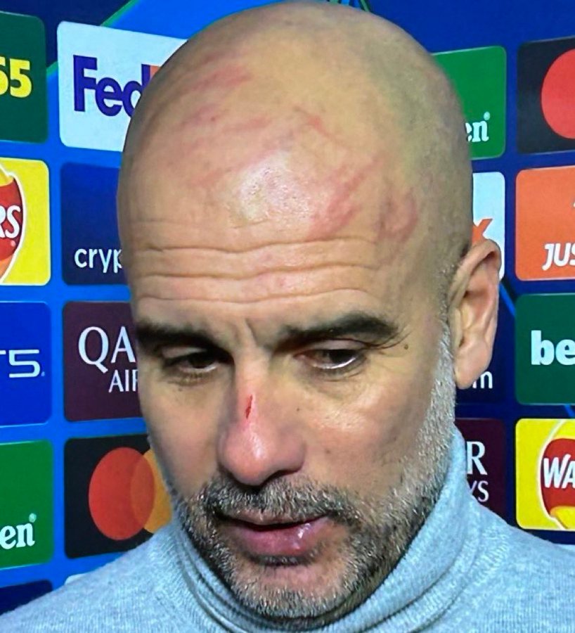 Le visage de Pep Guardiola après le match nul 3-3 concédé par City mardi soir:" J'ai eu envie de me faire du mal !''