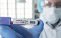 Compteur coronavirus : 594 cas testés positifs et plus de 3,7 millions de personnes vaccinées